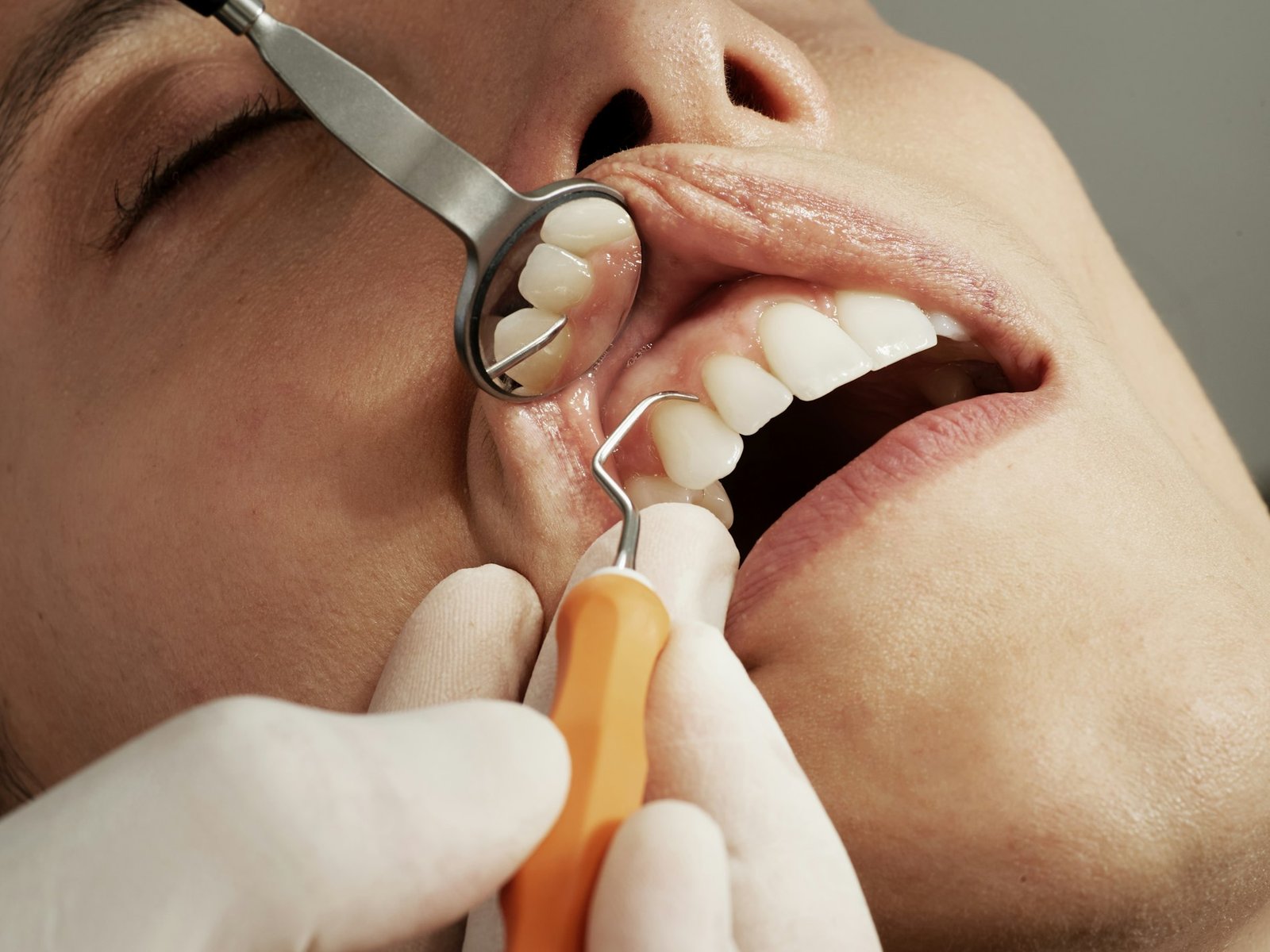 Dentista revisando la boca de un paciente con espejo y sonda